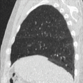 Thumbnail for version as of 22:33, 14 May 2026
