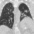 Thumbnail for version as of 22:32, 14 May 2026